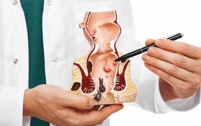 Fisura anal: causas, síntomas y aspectos que debes conocer