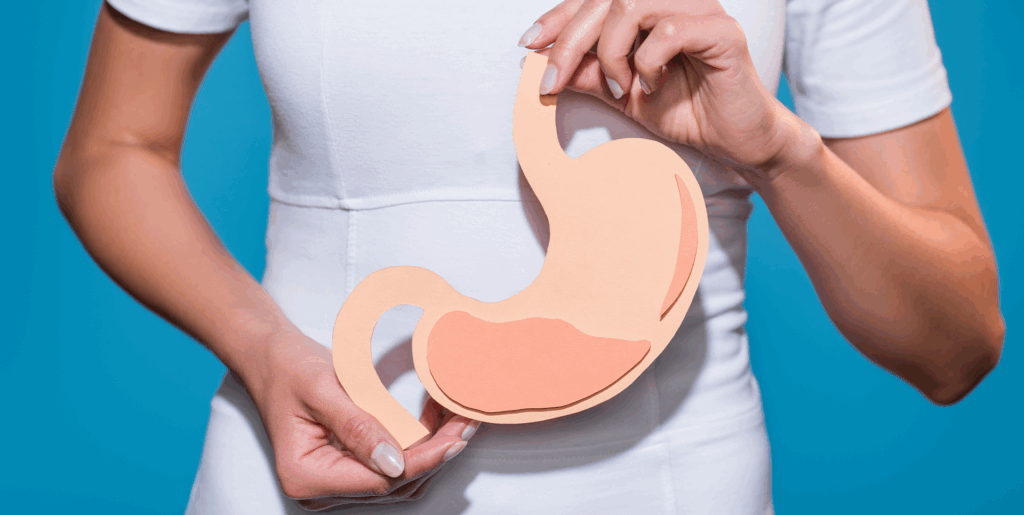 moco en heces, mujer sosteniendo una imagen de un intestino