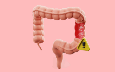 Prolapso rectal: qué es y cómo saber si lo tienes