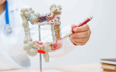 ¿Qué son las almorranas o hemorroides?: Tipos y causas